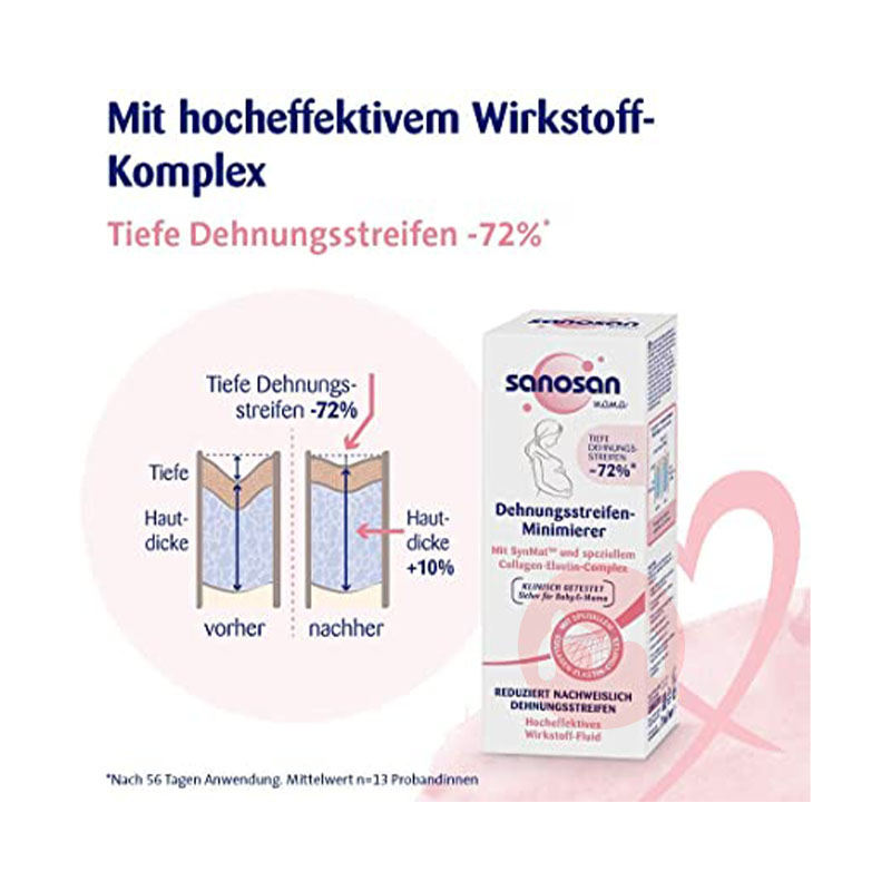 Sanosan 독일 임산부 스트레치 마크 라이트닝 크림 오리지널 해외